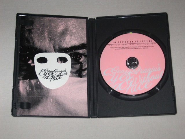 Screen capture from Eyes Without a Face